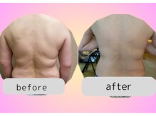 ヨサパーク ハーブ Melody亀山店(YOSA PARK)/痩身/ダイエット/リンパ/産後