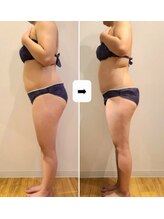 ワンルーム(1ROOM)/