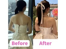 ボディキュア ブライダル美容整体 大阪梅田/ドレスが似合う自分に♪/関西