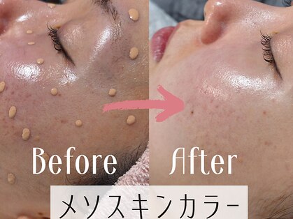 マールム(MALUM)の写真