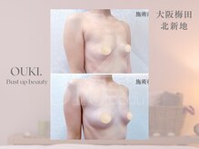 【育乳・バスト専門×女性らしさを磨く】OUKI. 梅田北新地【3月1日 OPEN（予定）】/バスト結果写真