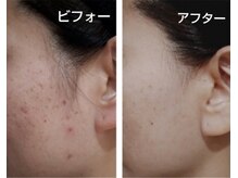 扶々の雰囲気（花粉＆ゆらぎ肌シーズン！肌トラブルには早めのケアがおすすめ◎）