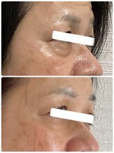 ビープラスサロン(Be plus salon)/