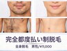 【初回11000円】メンズ全身脱毛｜ひげ＋VIO込（完全都度払い制）