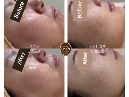 ラカ 川中島店(LaKa)の写真