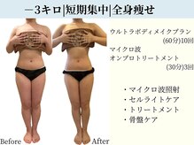 京都フォーエイチ(京都4H)/－3キロ|全身痩せ|短期集中ケア