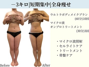京都フォーエイチ(京都4H)/－3キロ|全身痩せ|短期集中ケア