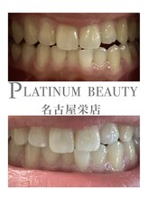 プラチナムビューティー 名古屋栄本店(PLATINUM BEAUTY)/お客様Before After