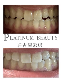 プラチナムビューティー 名古屋栄本店(PLATINUM BEAUTY)/お客様Before After