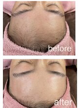 ラフレ(Rafre)/フェイスワックス