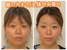 ドクター小顔 銀座店(Dr.小顔)/30代女性