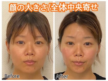 ドクター小顔 銀座店(Dr.小顔)/30代女性