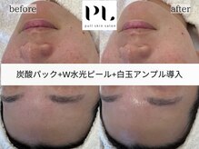 プルスキンサロン 大阪店(pull skin salon)/