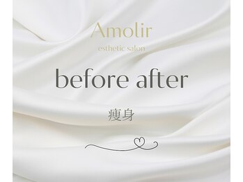 アモリール(Amolir)/痩身　ビフォーアフター