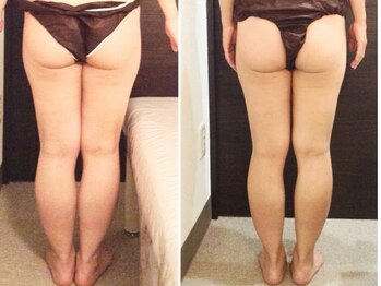 美容整体ウェリナ あま甚目寺院/小顔矯正/骨盤矯正/美脚サロン