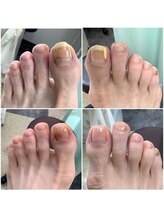 カリテス 富ヶ谷店(charites)/ 爪ケア