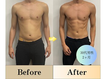 ニコ 千葉店(NICO)/憧れの腹筋ライン作れます