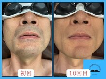 トミー(TOMMY)の雰囲気（毎朝10分シェービングに時間が必要だったお客様が3週間に1回に♪）