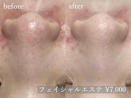アルム(a'lm)の写真