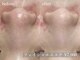 アルム(a'lm)の写真