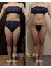 ★人気No. 1本気の痩身エステ【結果重視！贅肉撲滅】全身90分¥30800→¥14400