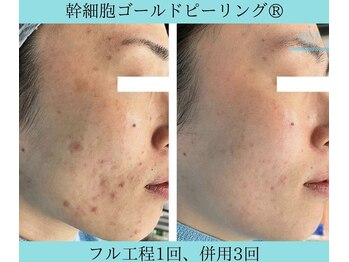 リメイク 広尾(REMAKE)/