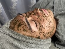 ムーンサン(Moon sun)/メンズ/ハーブピーリング