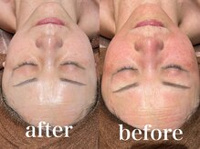 ディアーム 光明池店(Diarm)/陶肌ピール