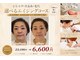 イーズ 武蔵小杉店の写真/圧倒的に人気☆『圧倒的リフトアップ小顔￥5500』筋肉の衰えや、顎下のたるみ改善!!ドライヘッド付き☆