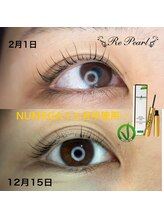 リパール 市駅前店(Re Pearl)/美容液使用