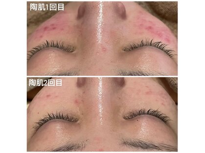 ウィズユー(with U)の写真