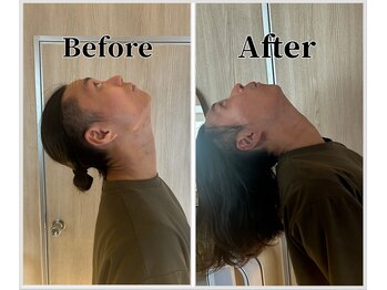 整体ラルース 中目黒(LALUZ)/20代 男性 ストレートネック改善