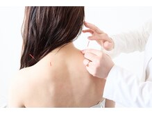 インヤン(yinyang)/