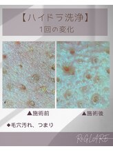 リグレア 浦安(Re.GLARE)/つまり、ざらつき