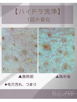 リグレア 浦安(Re.GLARE)/つまり、ざらつき