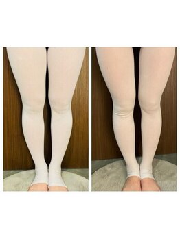 ココフィット(COCOFIT)の写真/垂れ下がったお尻からパンツを履きたくなるプリッとしたヒップに♪