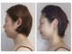 サラ 神楽坂(Sara)の写真/フェイスラインも、たるみ毛穴も気になる方へ。