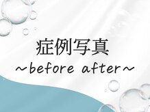 シャルトルズ 西宮北口店/【症例写真】