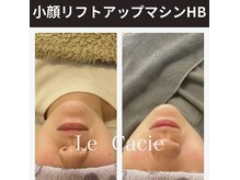 ルカシエ(Le Cacie)の雰囲気（最速で小顔へ！頭蓋小顔矯正&リフトアップマシンHBのコラボ）