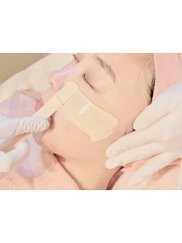 顔脱毛がしたい