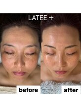 ラテプラス(LATEE＋)/外気の汚れ、花粉【50代】