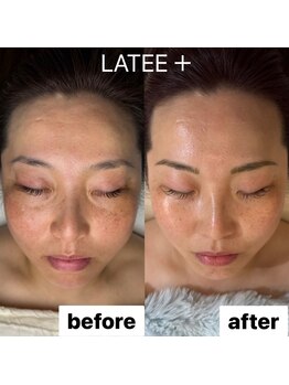 ラテプラス(LATEE＋)/外気の汚れ、花粉【50代】