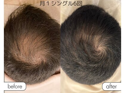 3(sun)の写真
