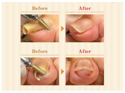 巻き爪調節院の写真