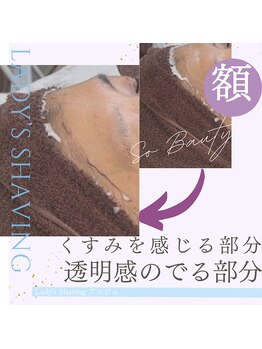 アンジュ/Before&After