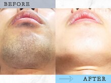 ラッシュ(RUSH)/3ヵ月＋メンテナンスで完了！