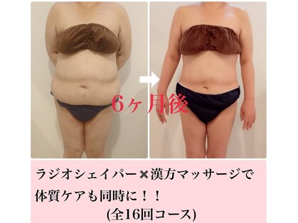 エステティックサロン エポック(epoque)の写真