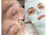 【新生活を迎える方へ】眉WAX+肌質改善エステで一気に垢抜け！¥10000/1回限り