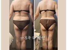 ムーン 高崎店(MOON)/痩身エステ