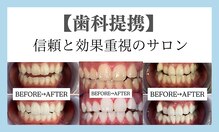 ホワイトニングサロン 宝塚